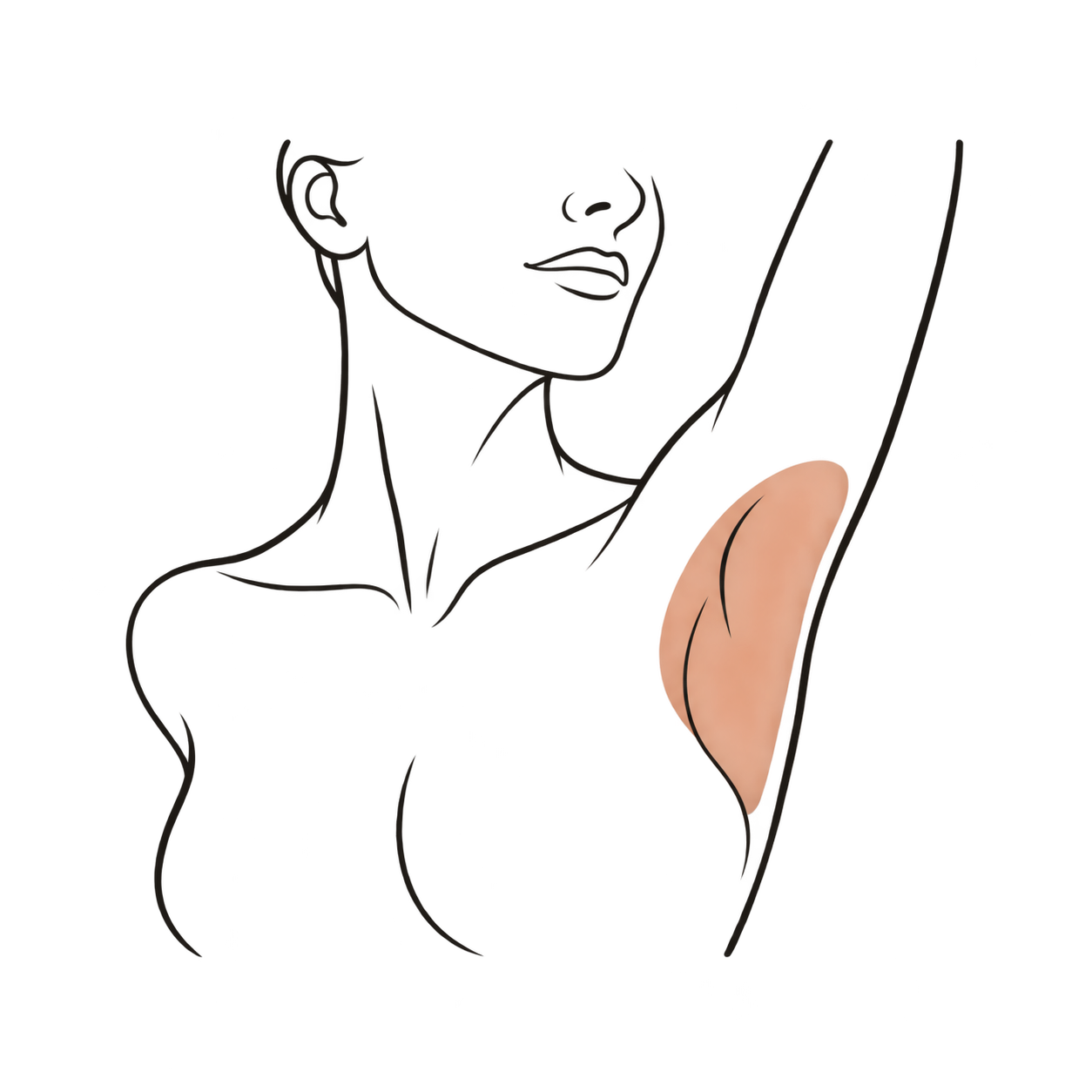 Ilustración del área de tratamiento