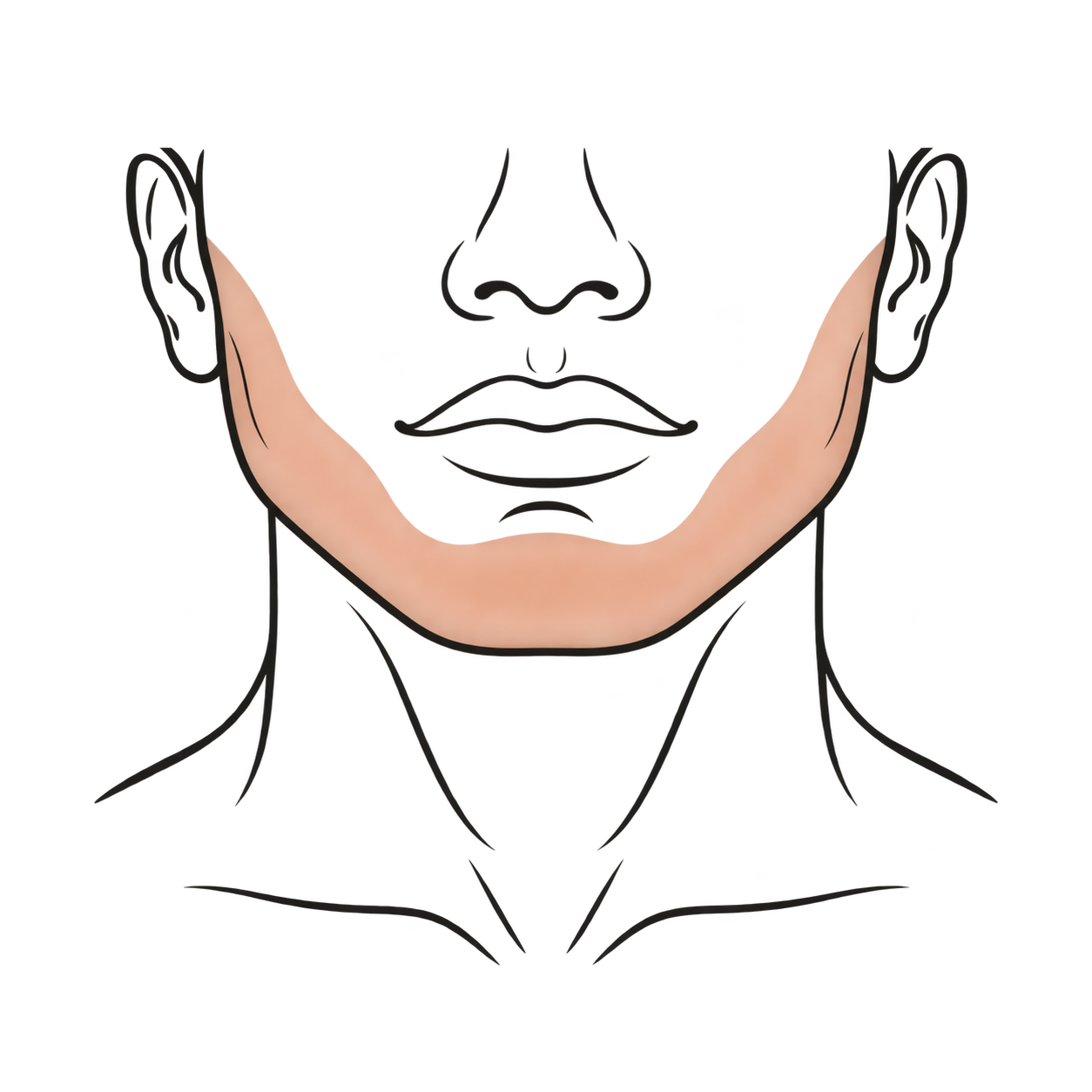 Ilustración del área de tratamiento