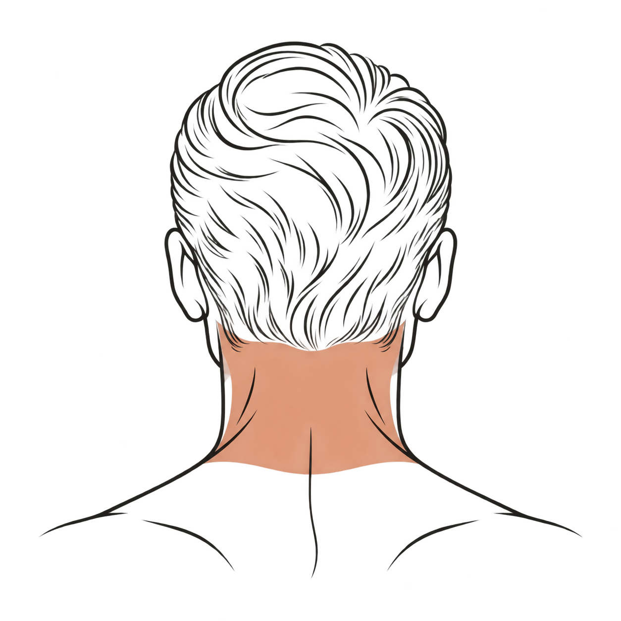 Ilustración del área de tratamiento