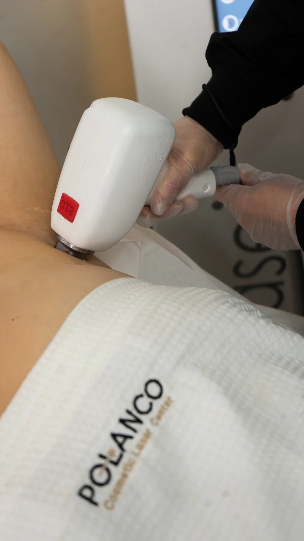 Atención del equipo de Polanco Laser en Tijuana Atención del equipo de Polanco Laser en Tijuana